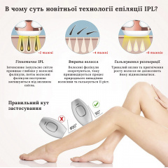 Фотоэпилятор SBT group Intense Pulse Light White IPL109 Ужгород