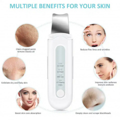 Скрабер портативный ультразвуковой для чистки лица с EMS и ионизацией Ubeauty Beauty Effect WAU-55 Куйбишеве