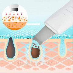 Ультразвуковой скраббер для очистки лица Skin Tech Scrubber 3305 Белый (3305O) Чорноморськ
