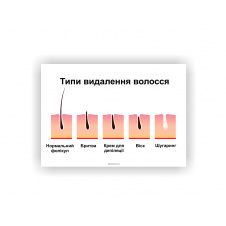 Плакат Типи видалення волосся 6 Vivay 0х80 см Білий