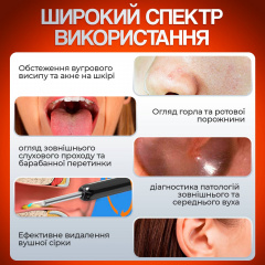 Прибор для удаления ушной серы с камерой Brillix 1296P Черный (PO-Black) Талалаївка