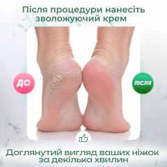 Электрическая пемза для ног CR 02 17х7,5 см Курень