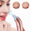 Вакуумний очищувач шкіри обличчя Beauty skin XN-8030 SMT 212732101 Сарни