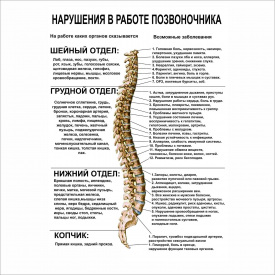 Плакат “Нарушения в работе позвоночника” А0