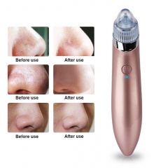 Вакуумный очиститель кожи Menqahahayd XN-8030 Pink (np2_00120) Одеса