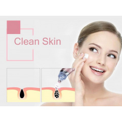Вакуумный аппарат для чистки пор лица Menqshahayd XN-8030 Pink (kz048-hbr) Переяслав-Хмельницький