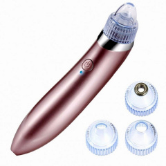 Вакуумный очиститель кожи Beauty Skin XN-8030 Миргород