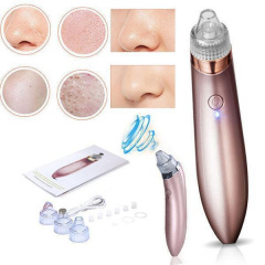 Вакуумный очиститель кожи Beauty Skin XN-8030 Миргород