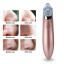 Вакуумный очиститель кожи Menqahahayd XN-8030 Pink (np2_00120) Одеса