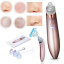 Вакуумный очиститель кожи Beauty Skin XN-8030 Миргород