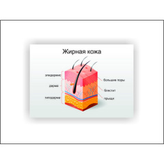 Плакат Vivay Жирна шкіра 30х40 см Білий Івано-Франківськ