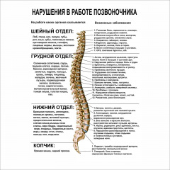 Плакат Порушення у роботі хребта Vivay А2 Київ