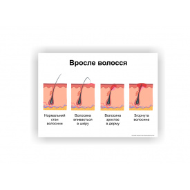 Плакат ламінований Vivay Вросле волосся А3 Різнокольоровий