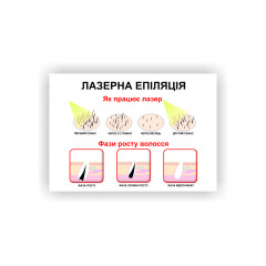 Плакат “Лазерна епіляція” Vivay 84х118 см Білий Кропивницький