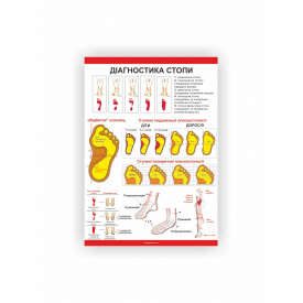 Плакат Діагностика стопи Vivay 60х80 см Білий