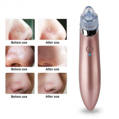 Вакуумний очищувач шкіри обличчя Beauty skin XN-8030 SMT 212732101 Сарни