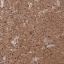 Тротуарная плитка Золотой Мандарин Кирпич Антик 240х160х90 мм полный прокрас персиковый Ужгород
