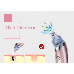 Вакуумный аппарат для чистки пор лица Menqshahayd XN-8030 Pink (kz048-hbr) Переяслав-Хмельницький