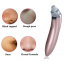 Вакуумный аппарат для чистки пор лица Menqshahayd XN-8030 Pink (kz048-hbr) Переяслав-Хмельницький