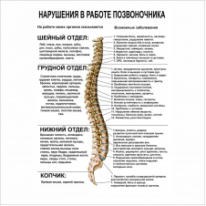 Плакат Нарушения в работе позвоночника А3