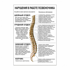 Плакат Vivay Порушення в роботі хребта А0 (4693)