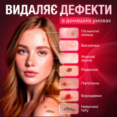 Электрокоагулятор плазменный для удаления папиллом/бородавок Brillix Point Mole Grey Оріхів