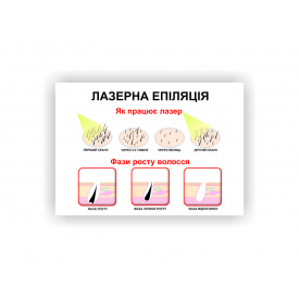 Плакат “Лазерна епіляція” Vivay 84х118 см Білий
